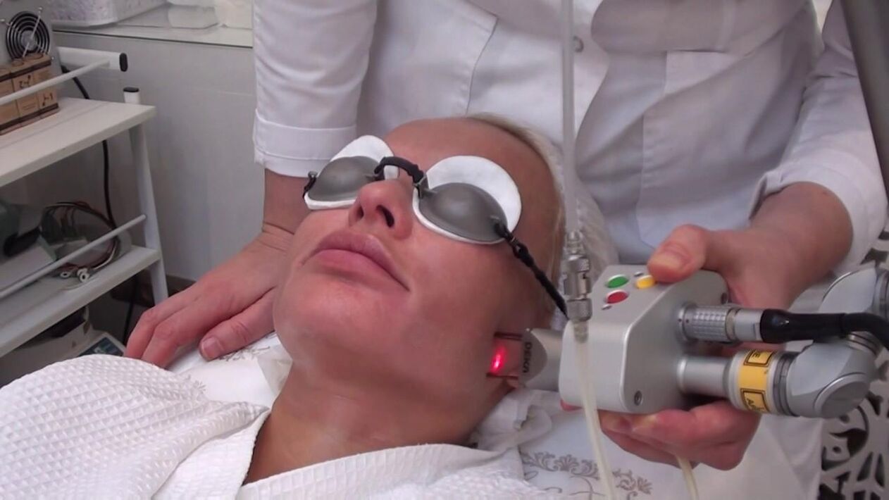 Treatment with a laser beam of problem areas of the skin of the face. 